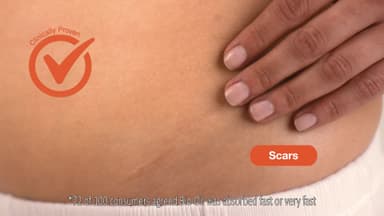 Bio Oil Body Skin Care Oil (125ml) - Firming Skincare That Reduces Appearance Of Stretch Marks & Scars - Grease Free Moisturiser Lotion - With Vitamin E & Vitamin A